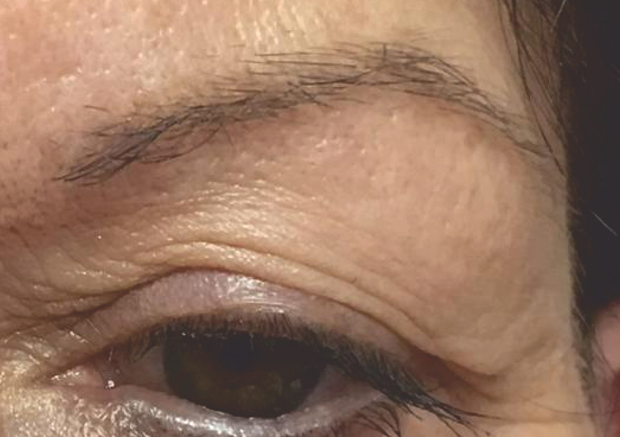 Permanent Make-Up Augenbrauen - Vor der Behandlung